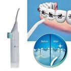 Portabledental001 Portable Dental China Nib Power Water Cleaner Floss Jet Pick