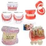 Dental Oral Study Standard Typodont Tissue Decomposition Teaching Model. Fixed Price $32.29.