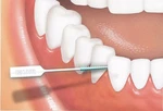 50 Gum Interdental Brushes Soft Picks Plaque Remover Clean Floss Sunstar. Fixed Price $19.62.