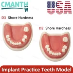 Us Dental Implant Model Soft Gums Drilling Training Open Suture Practice. Fixed Price $35.99.